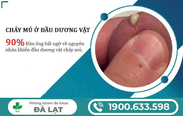 Hình ảnh minh họa